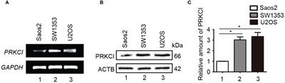 Downregulation of PRKCI inhibits osteosarcoma cell growth by inactivating the Akt/mTOR signaling pathway